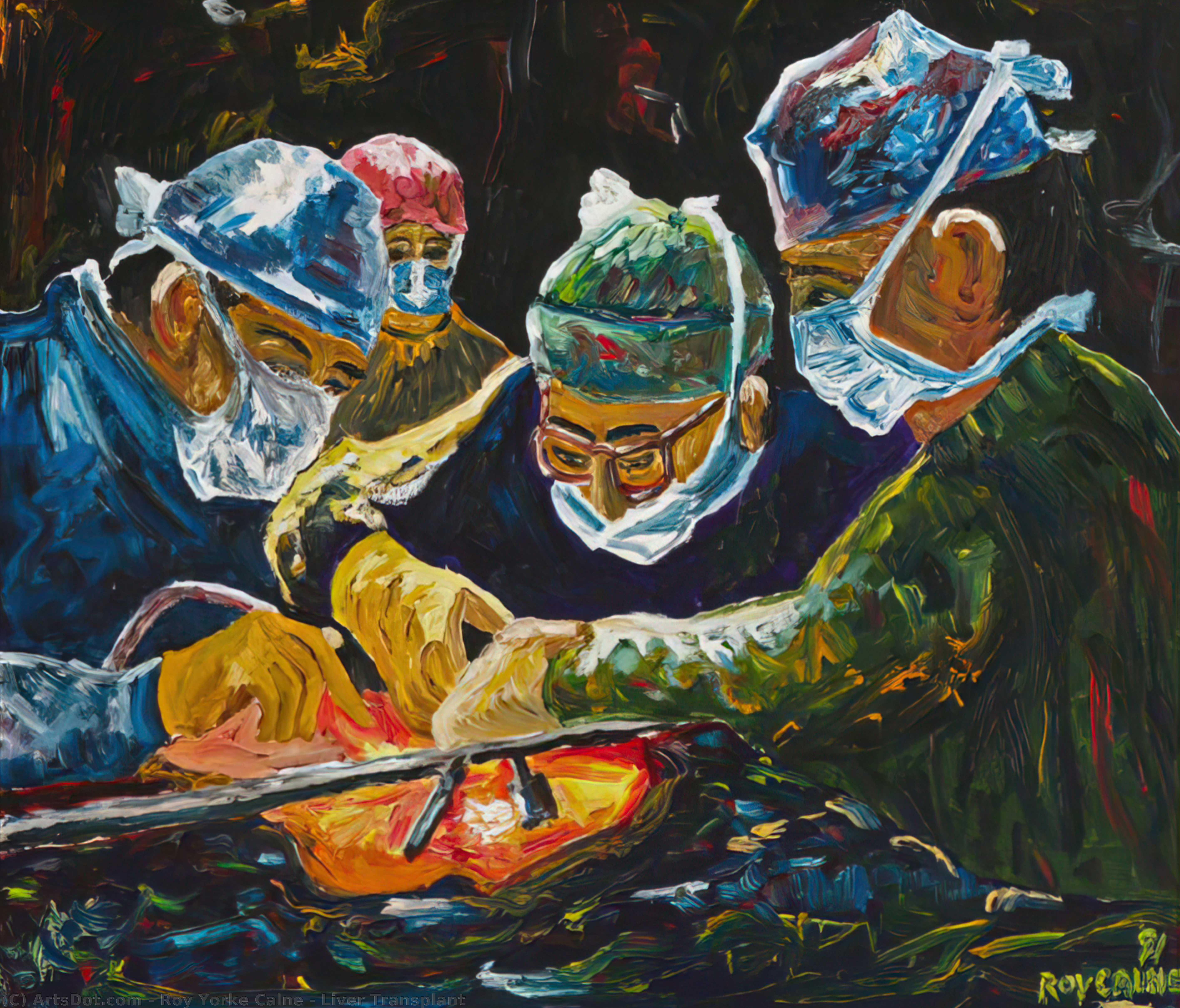 Liver Transplant, 1991 by Roy Yorke Calne Roy Yorke Calne | ArtsDot.com