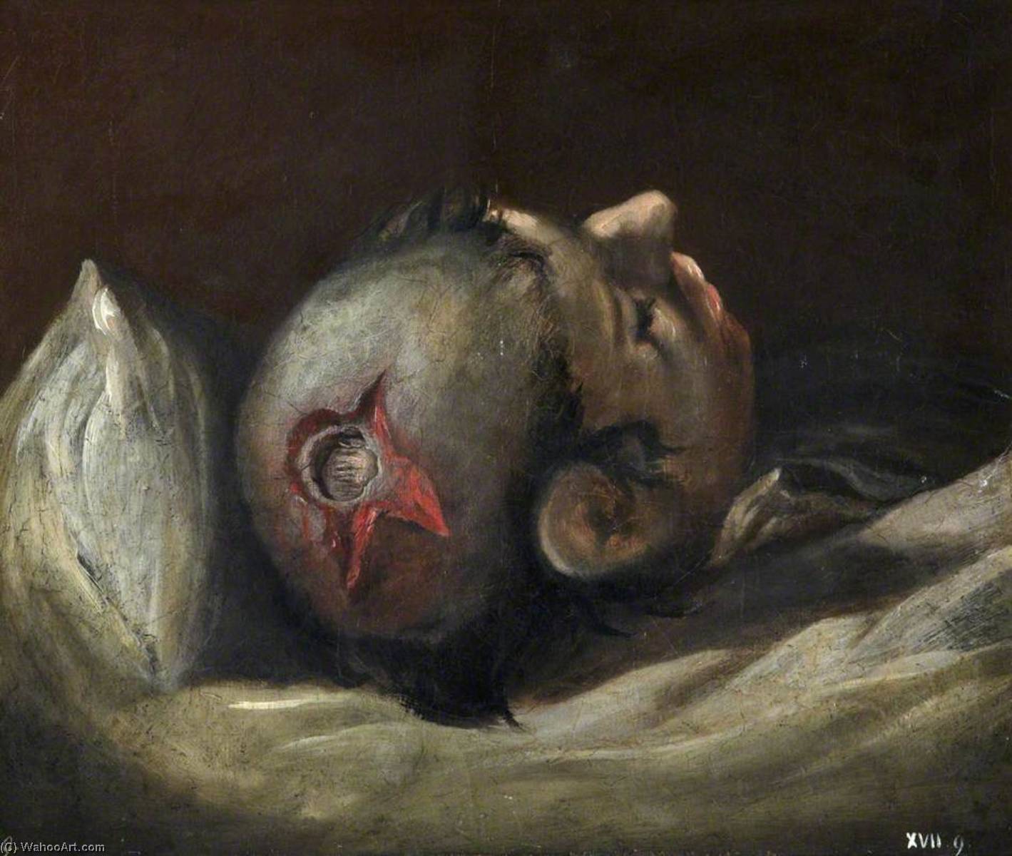Bestellen Gemälde Reproduktionen Die Verwundeten nach der Schlacht von Corunna Musket Ball Wound of Skull, 1809 von Charles Bell (Inspiriert von) (1935-1995, United States) | ArtsDot.com