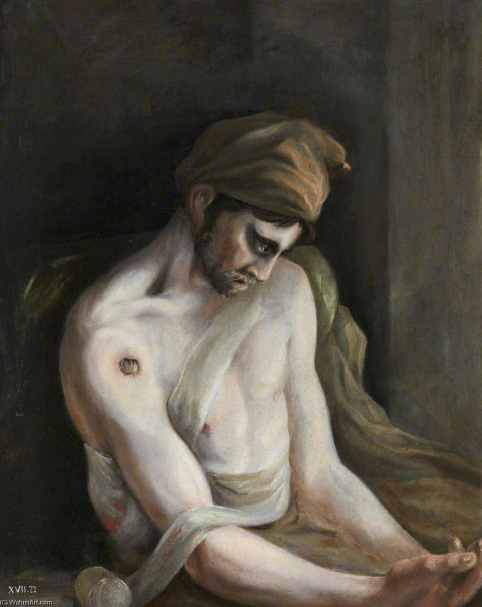 Order Artwork Replica The Wounded following the Battle of Corunna Gunshot Wound of Humerus, 1809 by Charles Bell (Inspired By) (1935-1995, United States) | ArtsDot.com