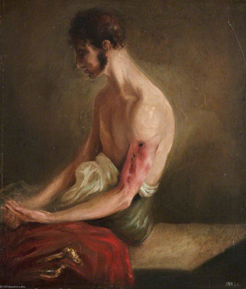 Order Art Reproductions The Wounded following the Battle of Corunna Gunshot Fracture of Shaft of Humerus, 1809 by Charles Bell (Inspired By) (1935-1995, United States) | ArtsDot.com