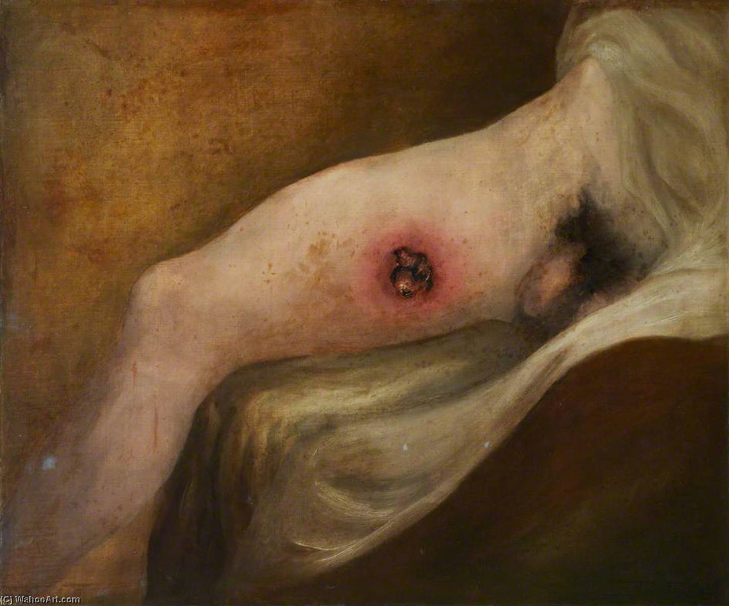 Order Oil Painting Replica The Wounded following the Battle of Corunna Gunshot Wound of Thigh, 1809 by Charles Bell (Inspired By) (1935-1995, United States) | ArtsDot.com