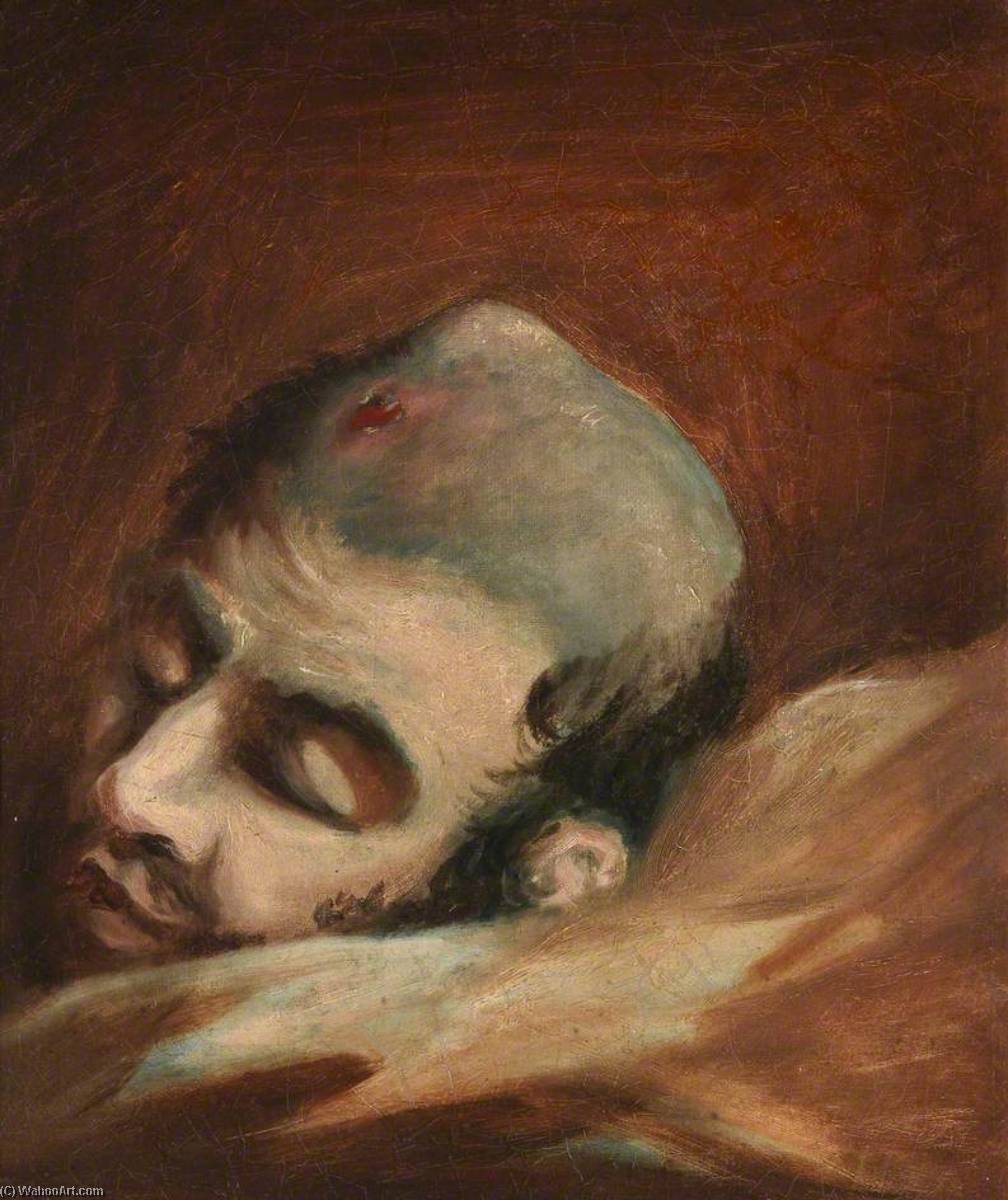 Order Paintings Reproductions The Wounded following the Battle of Corunna Bullet Wound of Skull, 1809 by Charles Bell (Inspired By) (1935-1995, United States) | ArtsDot.com