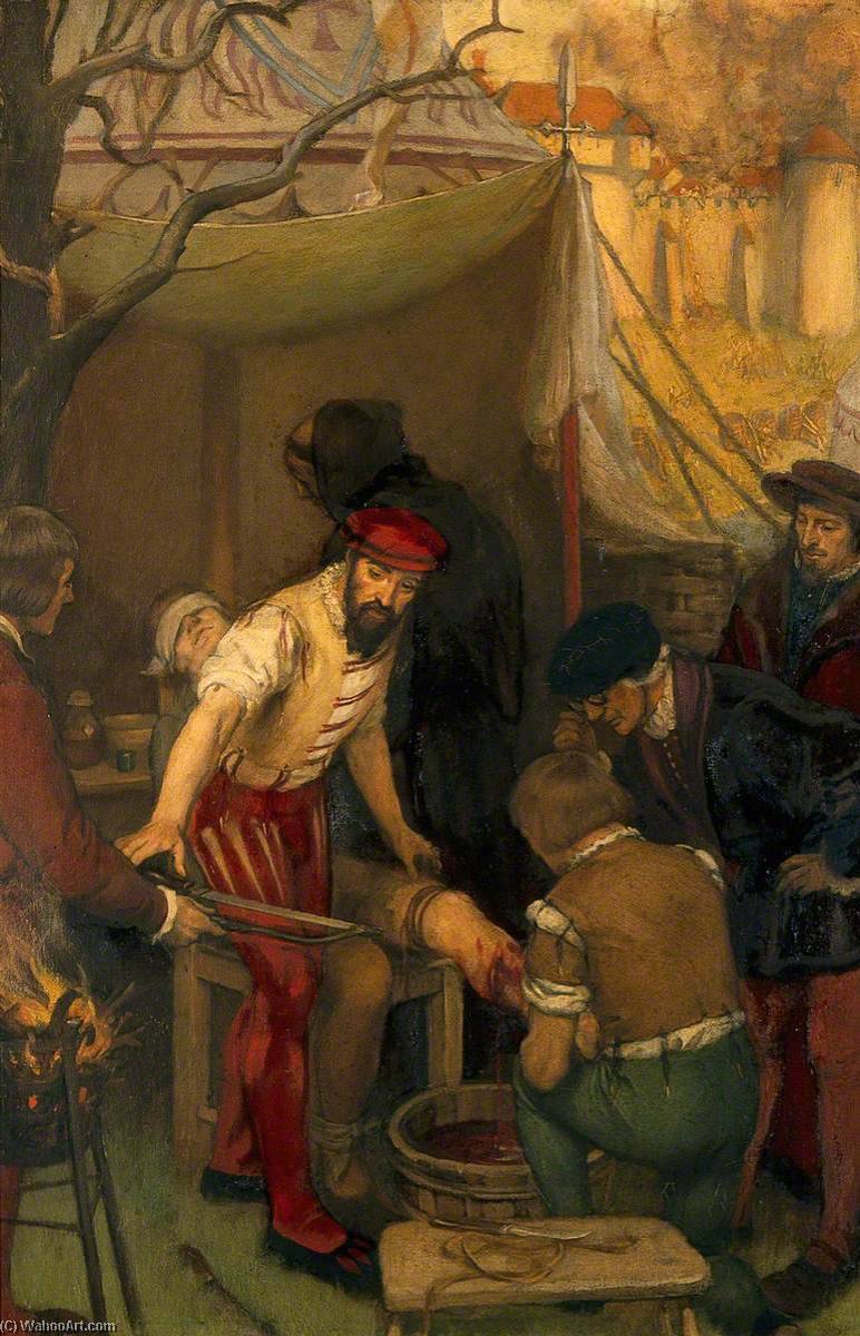 Kauf Museum Kunstreproduktionen Ambroise Paré Verwendung der Ligatur, wenn auf dem Schlachtfeld bei der Belagerung von Bramvilliers, 1552 von Ernest Board (1877-1934) | ArtsDot.com